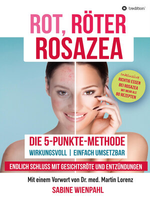 cover image of ROT RÖTER ROSAZEA